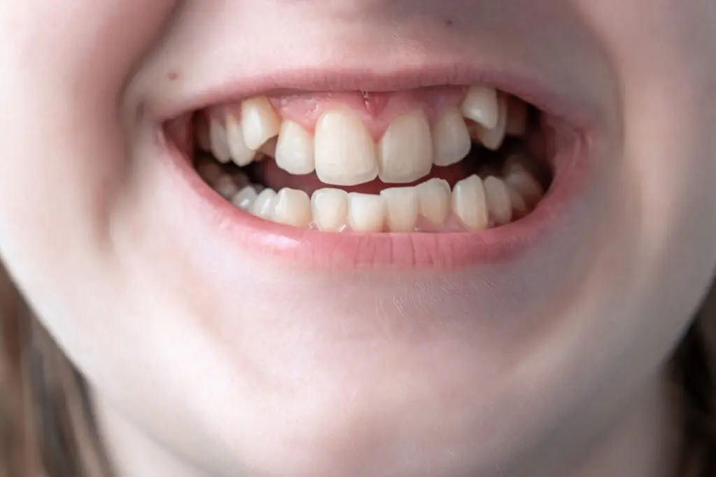 orthodontic treatment