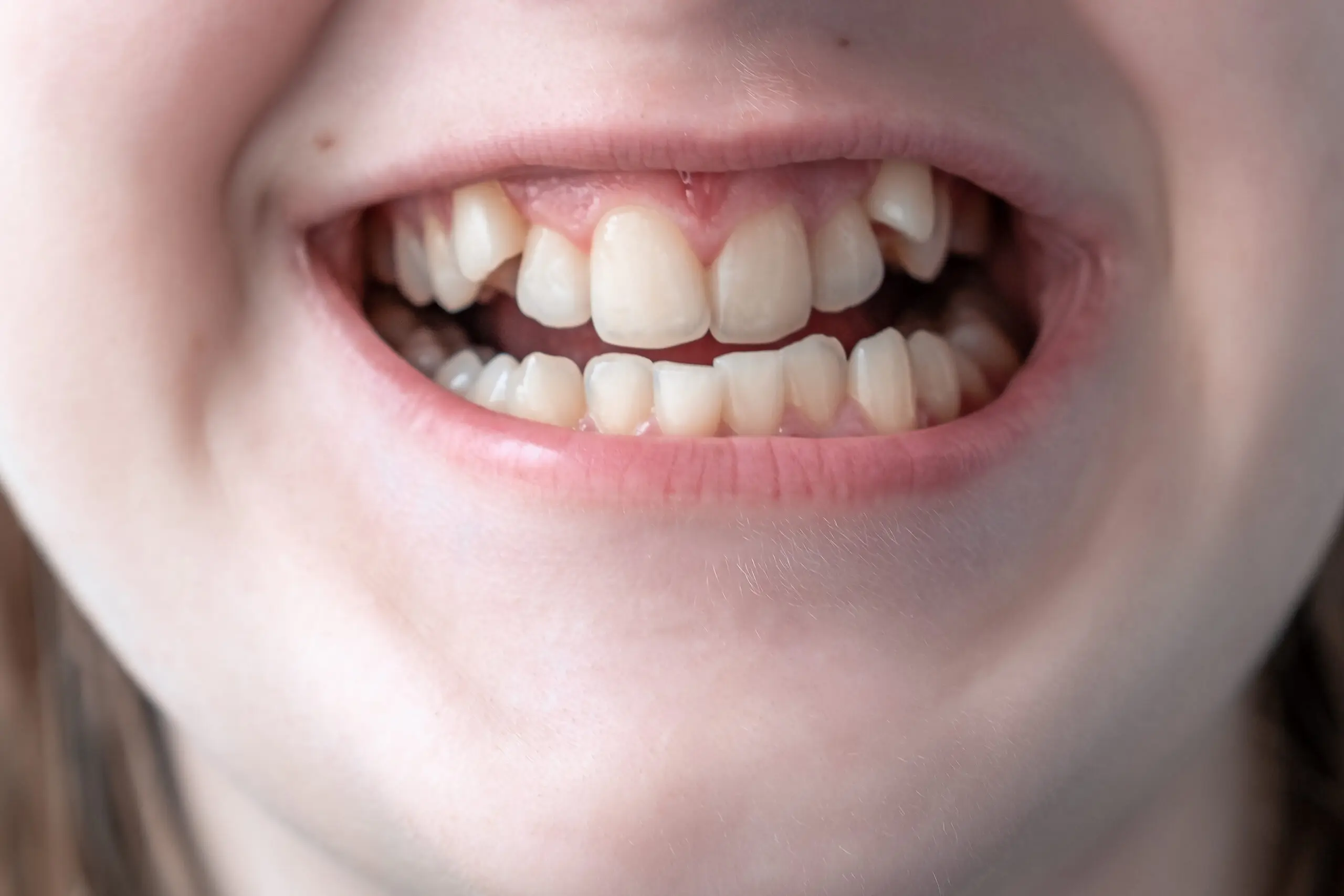 orthodontic treatment