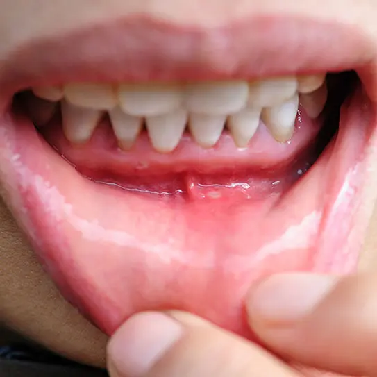Choice Dental Centre of Greenwood -
