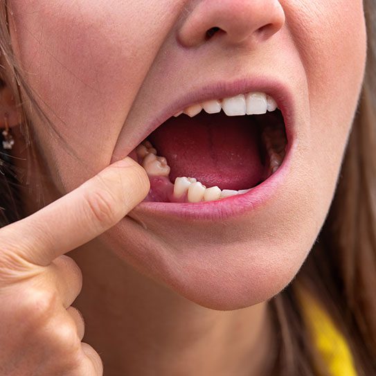 dentist near me dental implants Greenwood